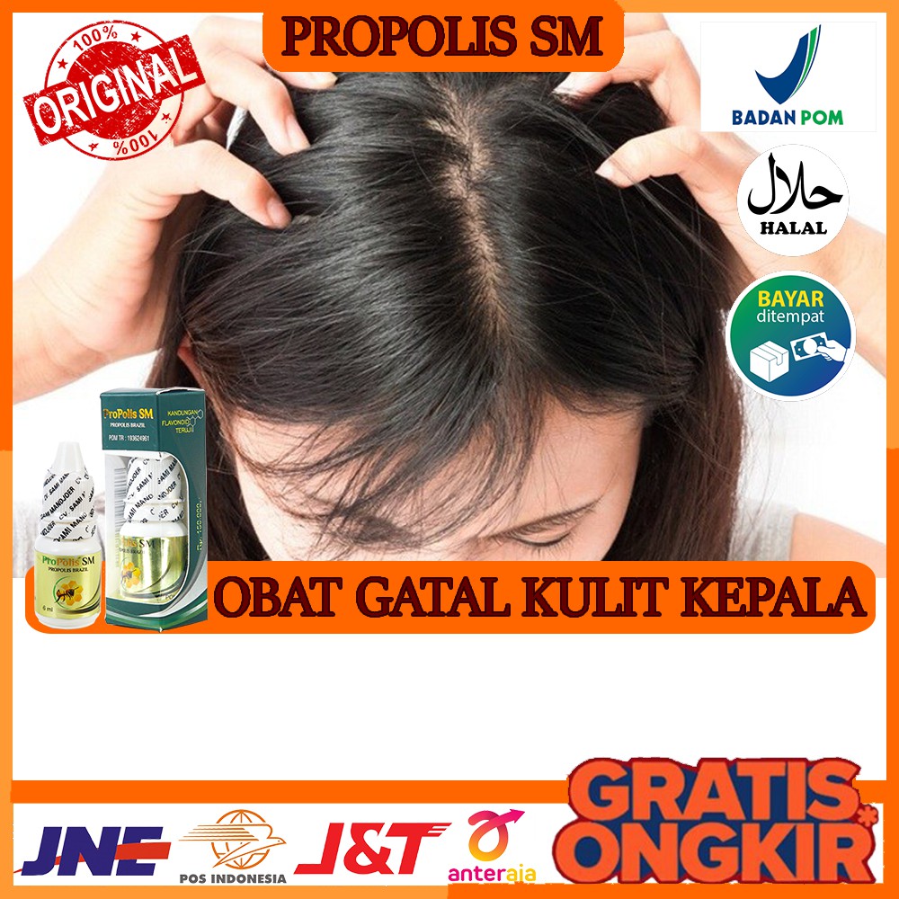 Jual Obat Alami Gatal Kulit Kepala Ketombe Parah Ketombe Menahun