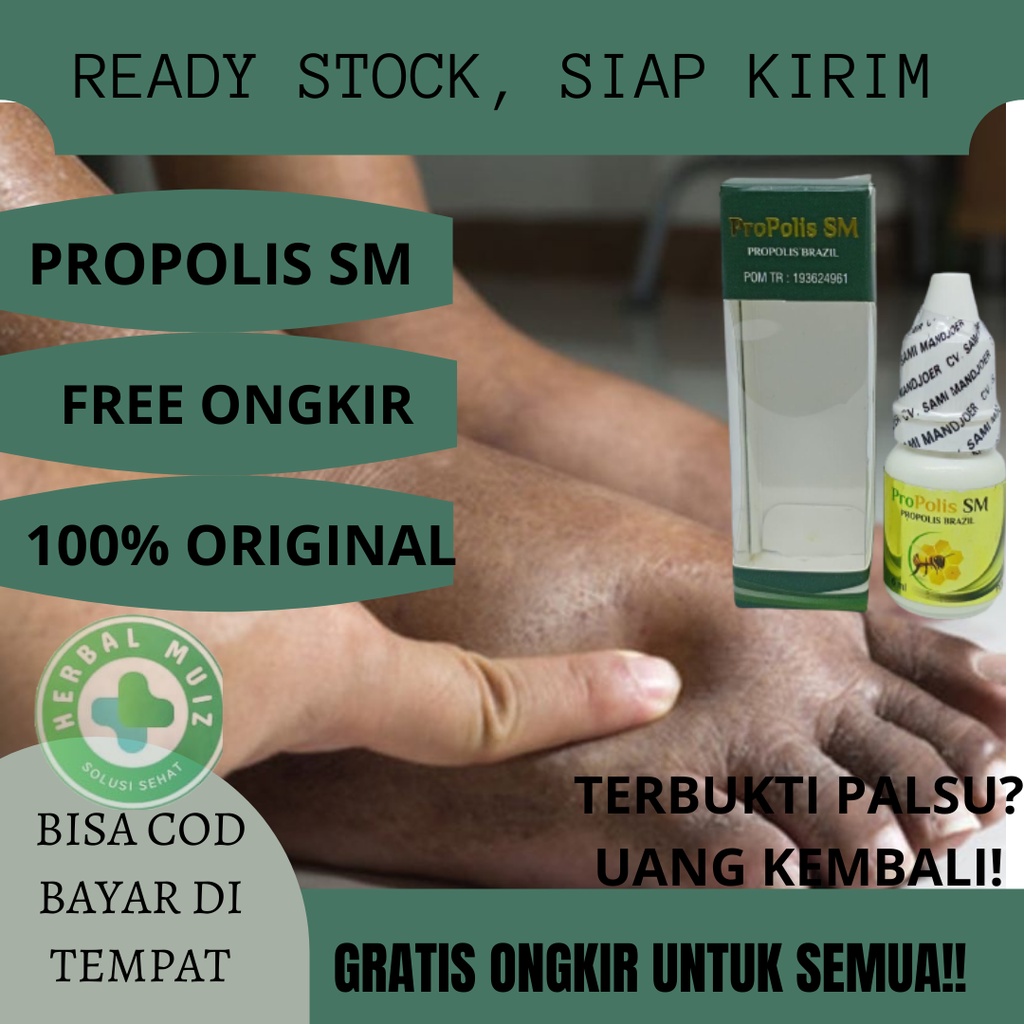 Jual Obat Herbal Kaki Kesemutan Kaki Bengkak Pergelangan Kaki Bengkak