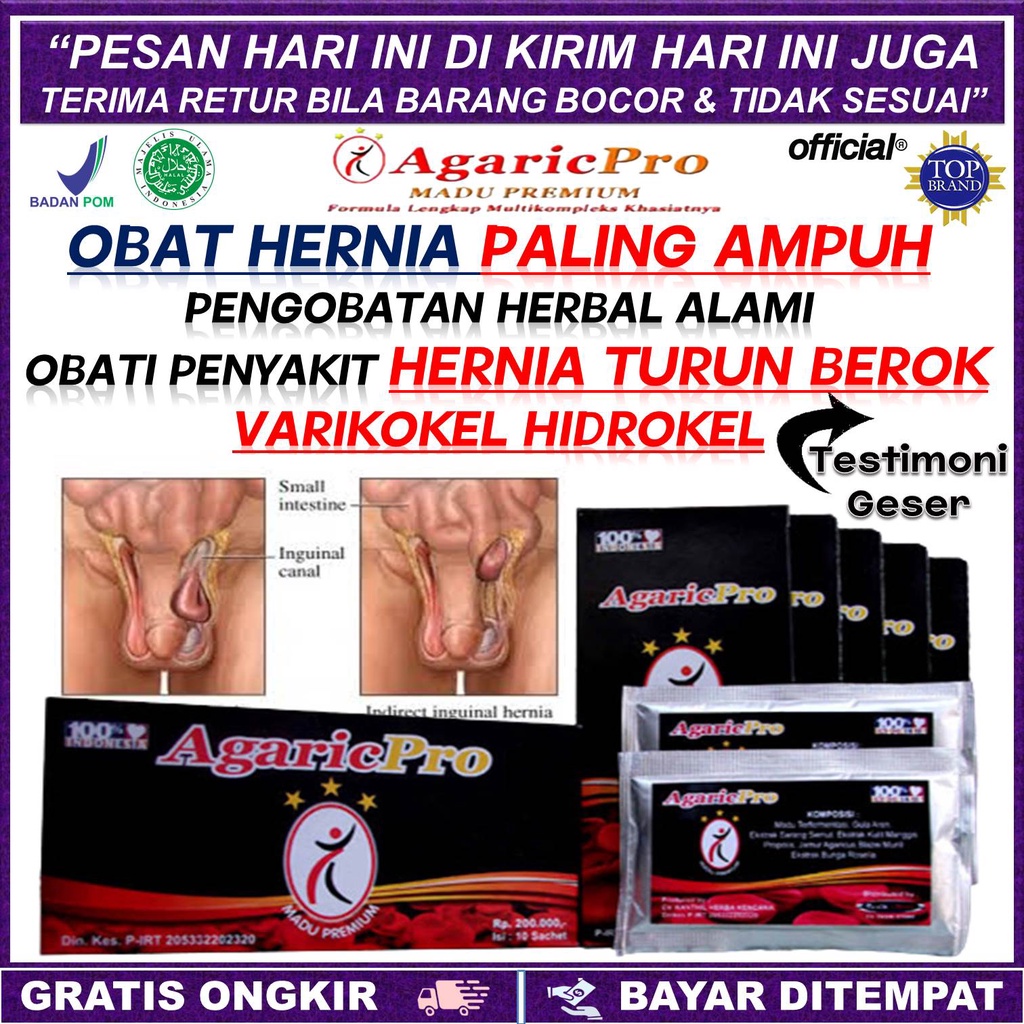 Jual Obat Hernia Paling Ampuh Tanpa Operasi Obat Turun Berok