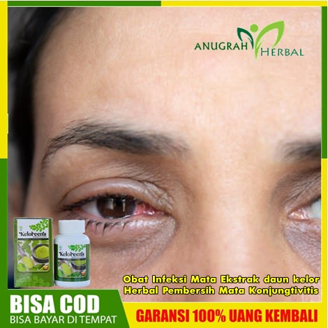 Jual Obat Infeksi Mata Ekstrak Daun Kelor Herbal Pembersih Mata