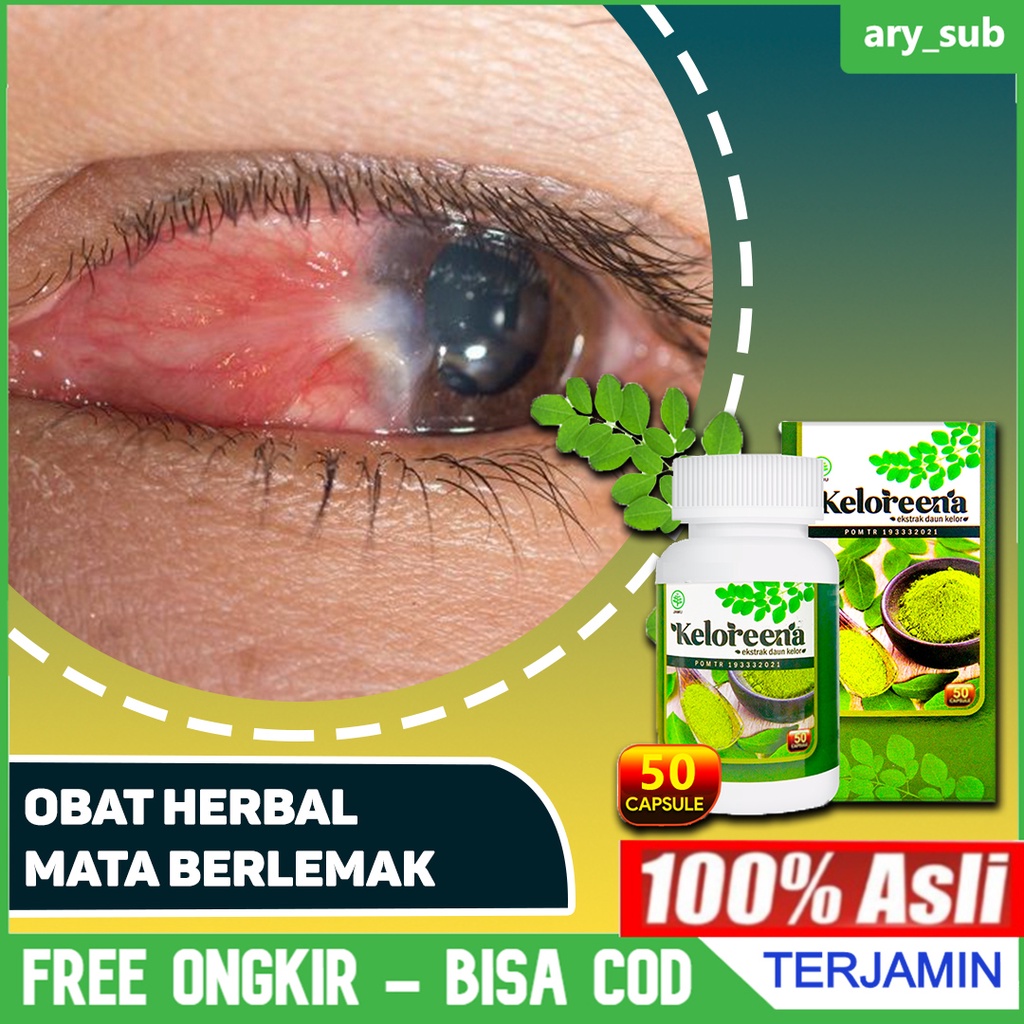 Jual Obat Mata Berlemak Pembersih Pterigium Pterygium Penghilang