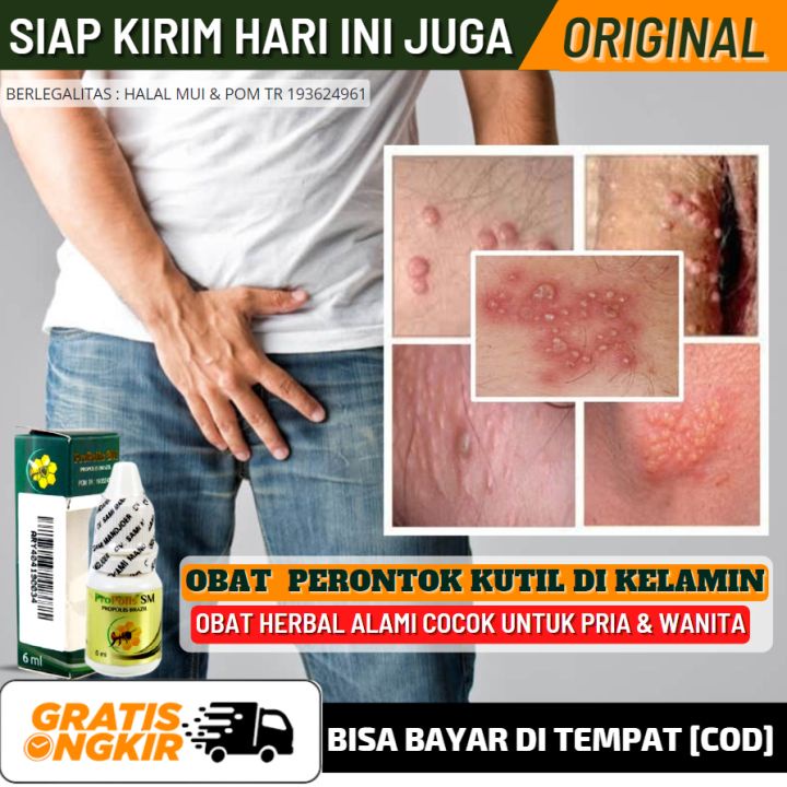 Jual Obat Oles Gatal Kemaluan Pria Obat Penis Gatal Menahun Infeksi