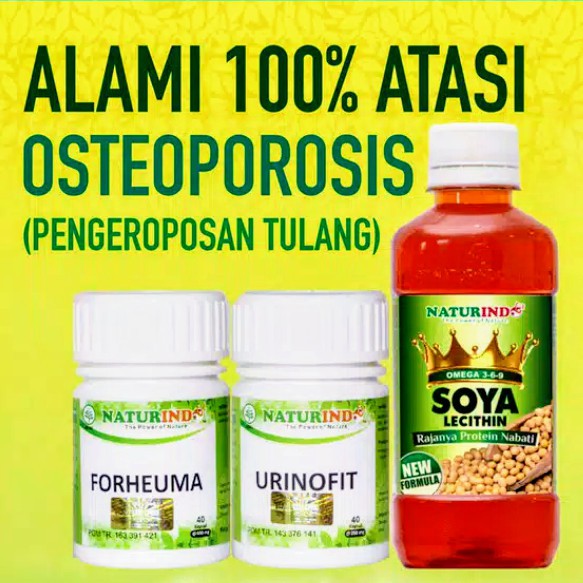 Jual Solusi Alami Atasi Osteoporosis Pengeroposan Tulang