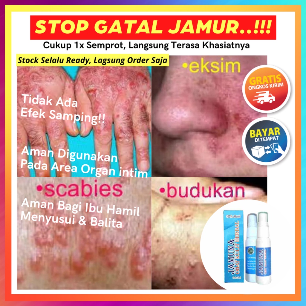 Jual OBAT GATAL SELANGKANGAN JAMUR PANU KADAS KURAP KUTU AIR PALING