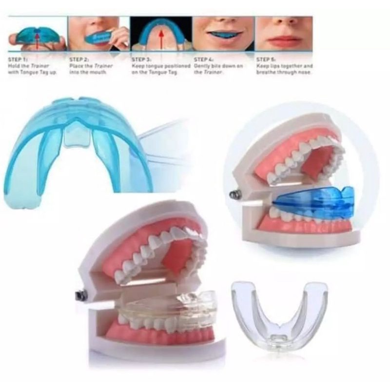 Jual ORTHODENTIC RETAINER TEETH TRAINER ALIGMENT BEHEL GIGI