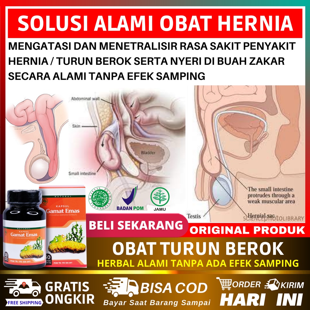 Jual Obat Hernia Turun Berok Dewasa Varikokel Hidrokel Testis Bengkak