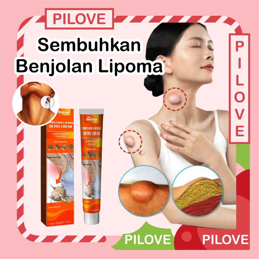 Jual PILOVE Obat Salep Cream Krim Untuk Penghilang Benjolan Kelenjar