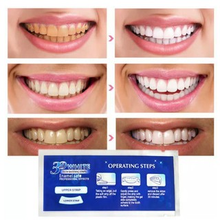 Jual Crest D Pemutih Strip Pcs Strip Gel Pemutih Gigi D Whitening