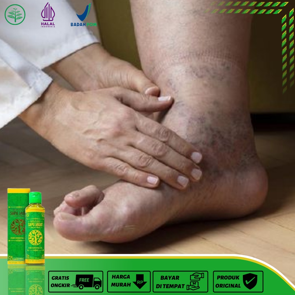 Jual Obat Kaki Bengkak Obat Bengkak Pada Kaki Obat Kaki Bengkak Dan