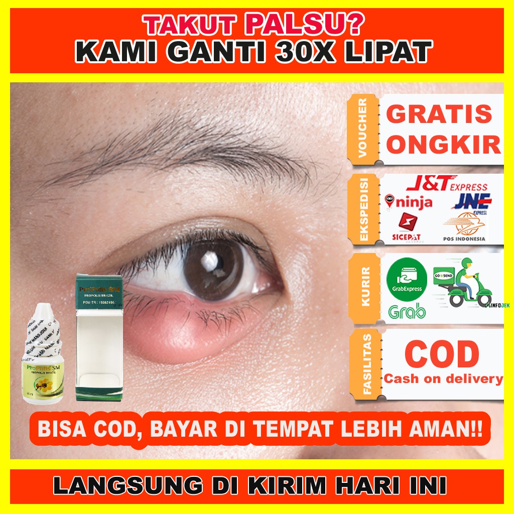 Jual Obat Benjolan Mata Mata Bintitan Mata Bengkak Penghilang