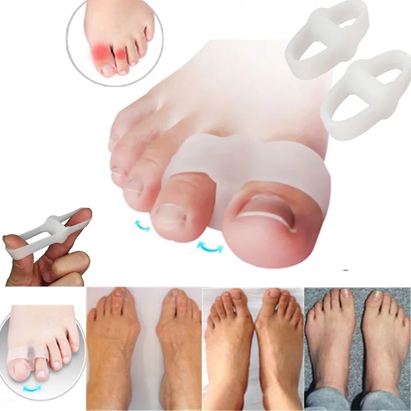 Jual Pelurus Jempol Jari Kaki Korektor Bunion Hallux Valgus Type