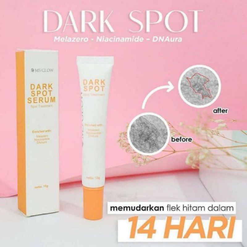 Jual ACNE SPOT DARK SPOT PORE AWAY Treatment Ms Glow Shopee Indonesia