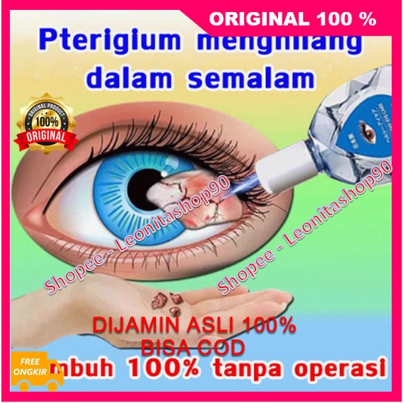 Jual Obat Tetes Mata Pterigium Menghilang Dalam Semalam Glaukoma