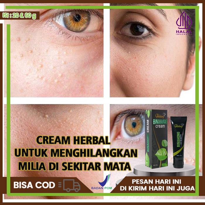 Jual Cream Penghilang Milia Ampuh Obat Milia Daerah Mata Obat Milia