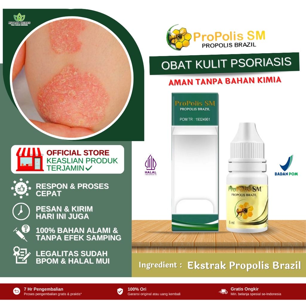 Jual Obat Psoriasis Kulit Kepala Obat Psoriasis Kulit Obat