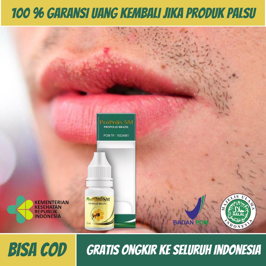 Jual Obat Penghilang Bintik Putih Di Bibir Penghilang Bintik Bintik