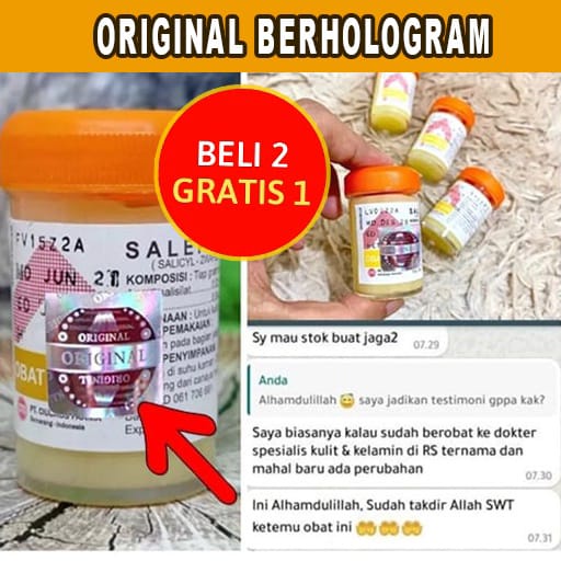 Jual Salep Gatal Paling Ampuh Obat Gatal Kulit Salep Original Kutu