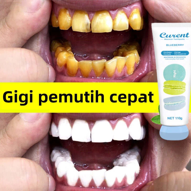 Jual Toothpaste Pasta Gigi Pemutih Gigi Dan Penghilang Karang Gigi Noda