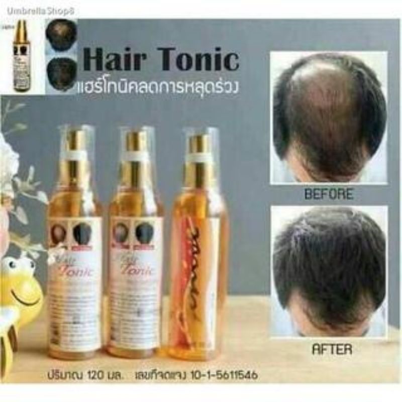 Jual HAIR TONIC GENIVE SERUM GENIVE Shopee Indonesia