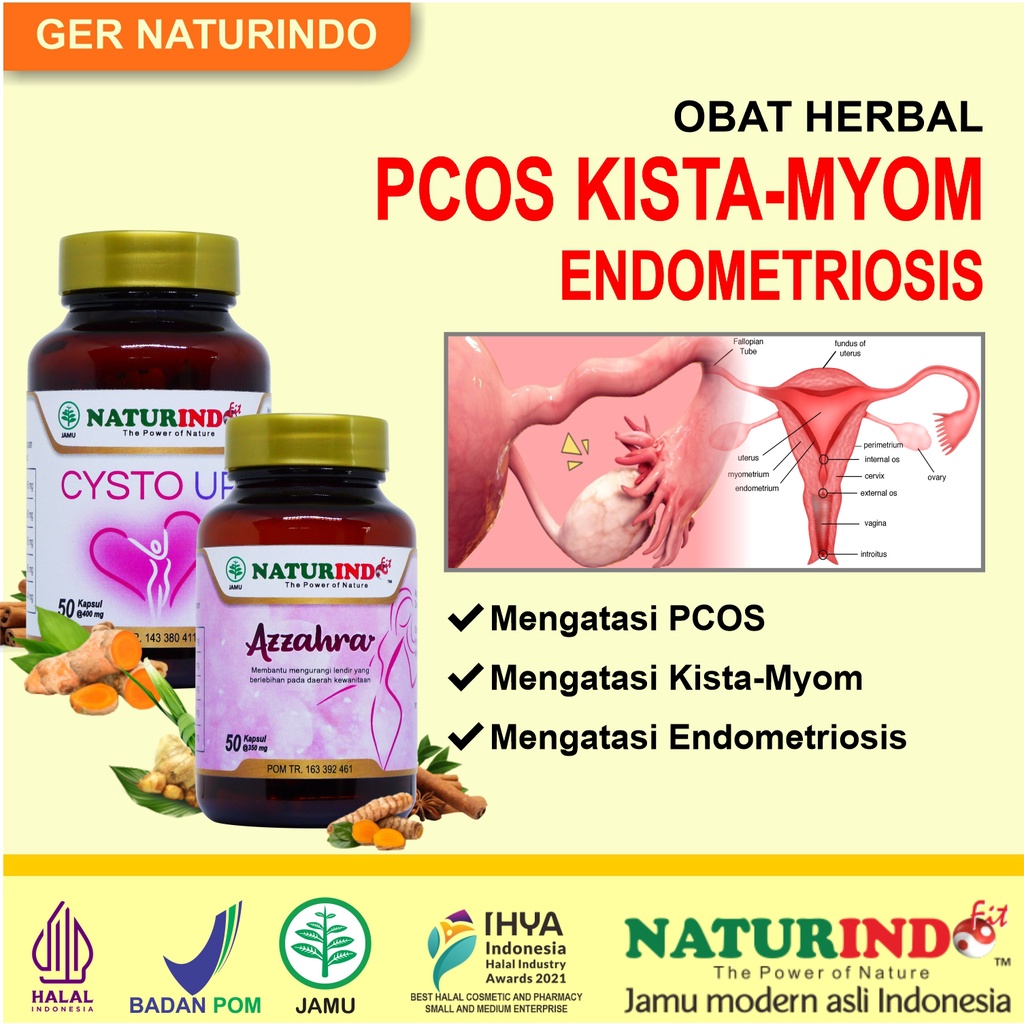 Jual Obat PCOS Kista Ovarium Endometriosis Bartholin Ampuh Tanpa