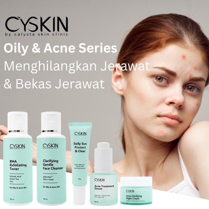 Jual Paket Acne Calysta Skin Care Jerawat Meradang Original Shopee