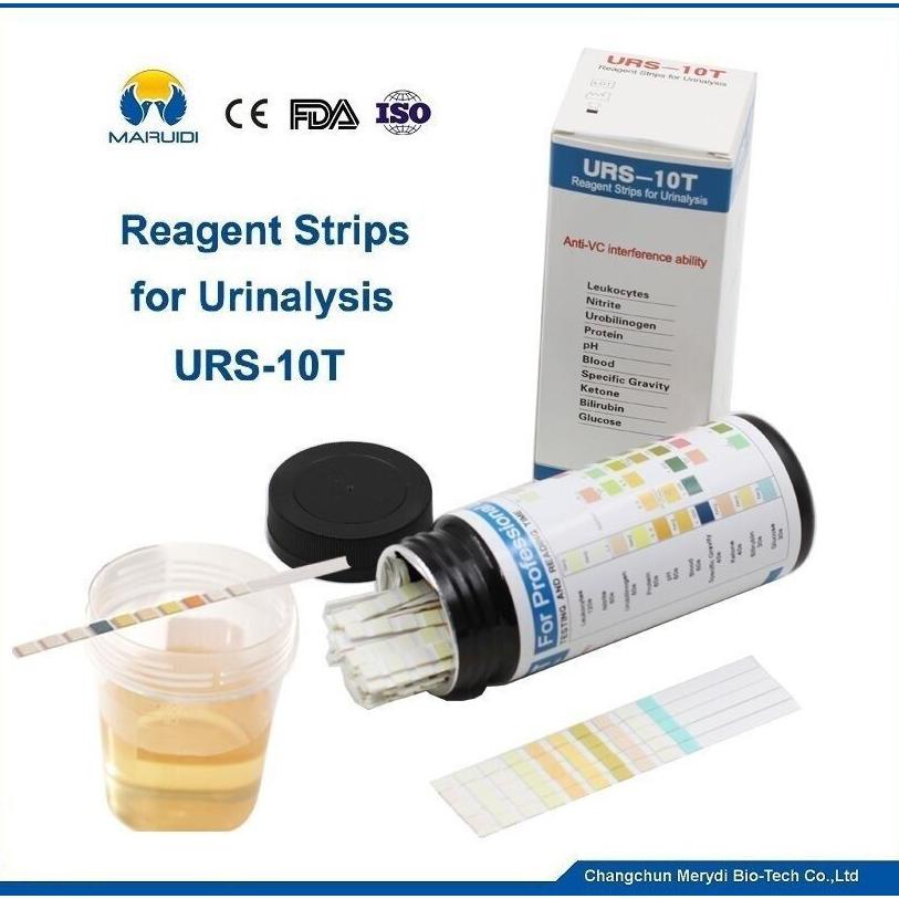 Jual Trending Urinalysis Reagent Strip Parameter Strip Test