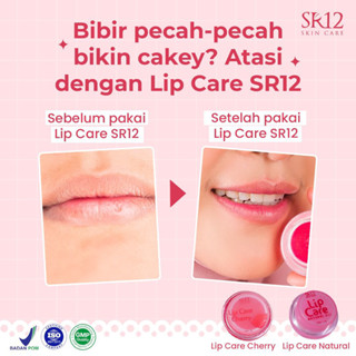 Jual Lip Care Sr Lip Balm Pelembab Bibir Pencerah Warna Bibir Alami