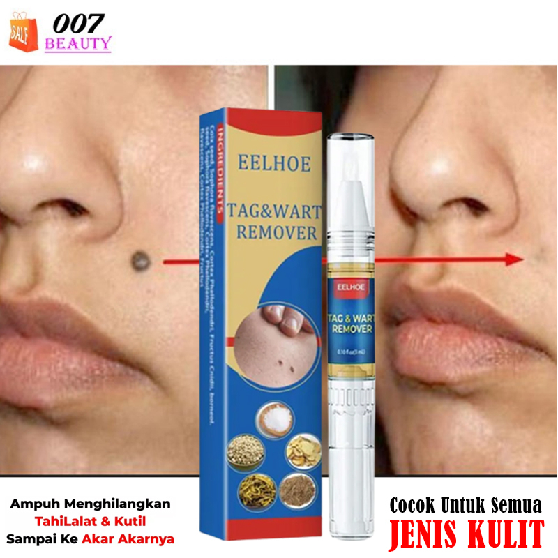 Jual SUMIFUN Salep Krim Obat Penghilang Tahi Lalat Dan Kutil EELHOE