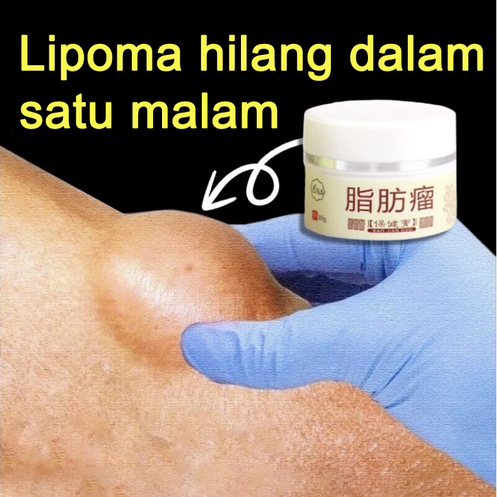 Jual Lipoma Benjolan Krim Penghapusan Lipoma Kulit Tonjol G Benjolan