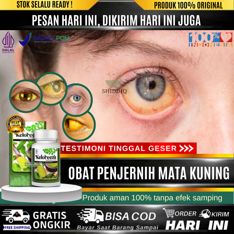 Jual Obat Mata Kuning Gangguan Liver Gangguan Hati Penyakit Kuning