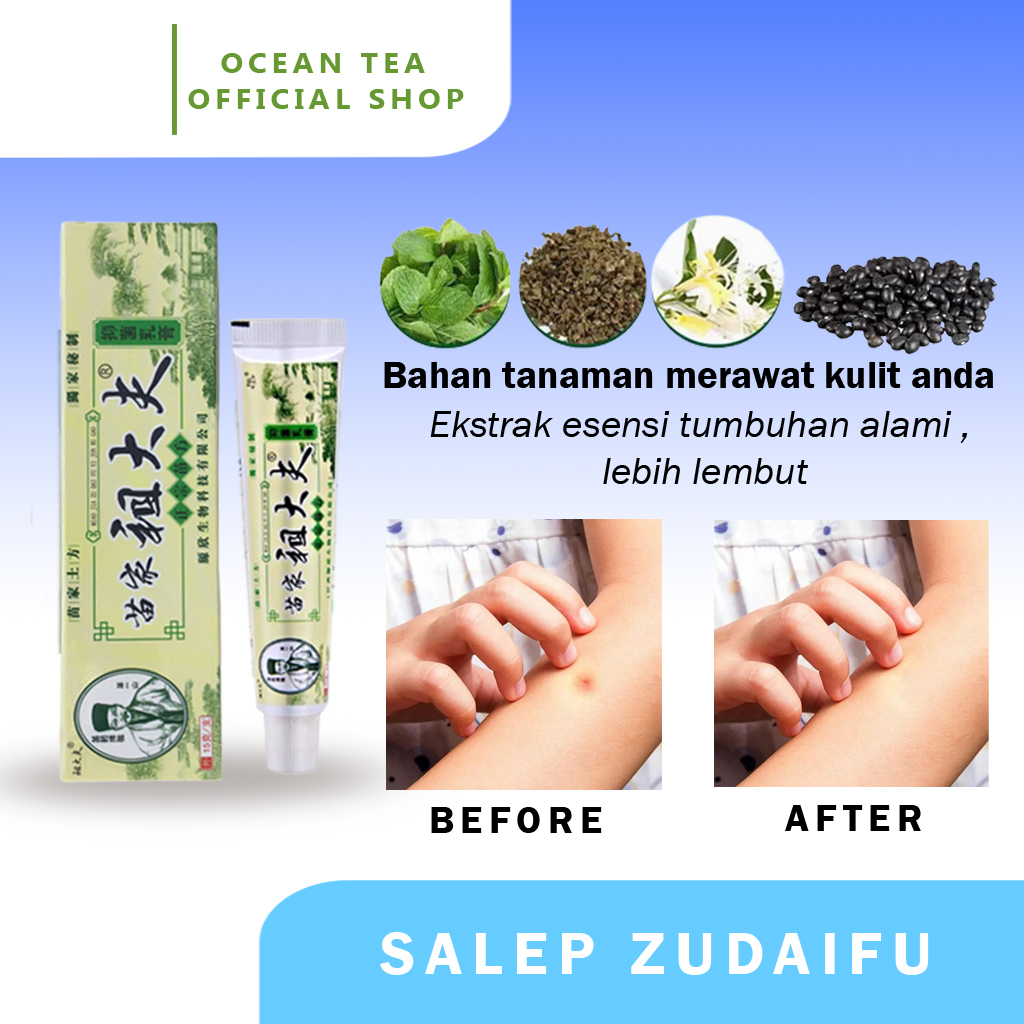 Jual Obat Gatal 100 Original ZUDAIFU Salep Gatal Salep Kulit Jamur