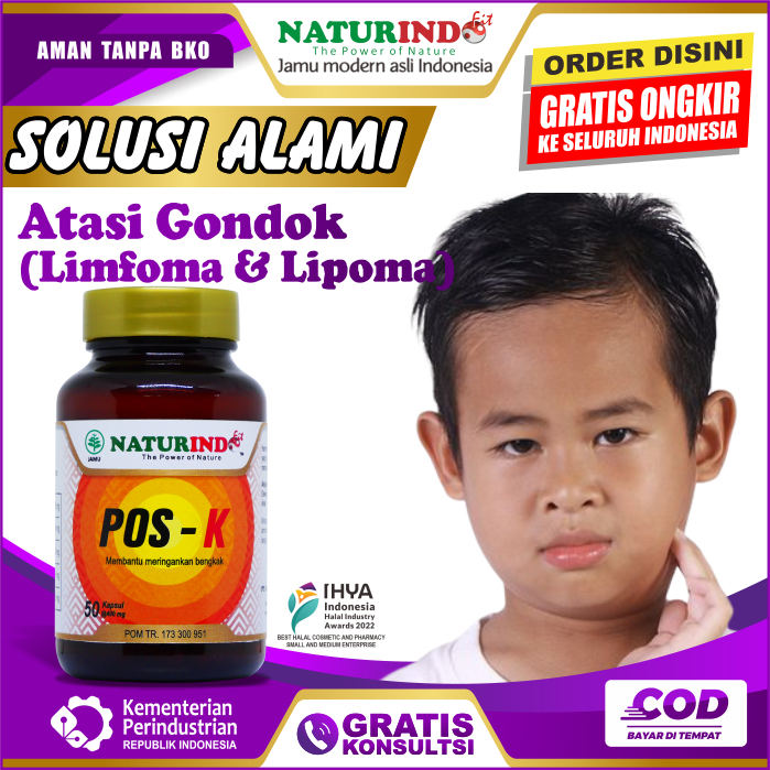 Jual Posk Obat Benjolan Di Leher Kelenjar Getah Bening Di Leher Di