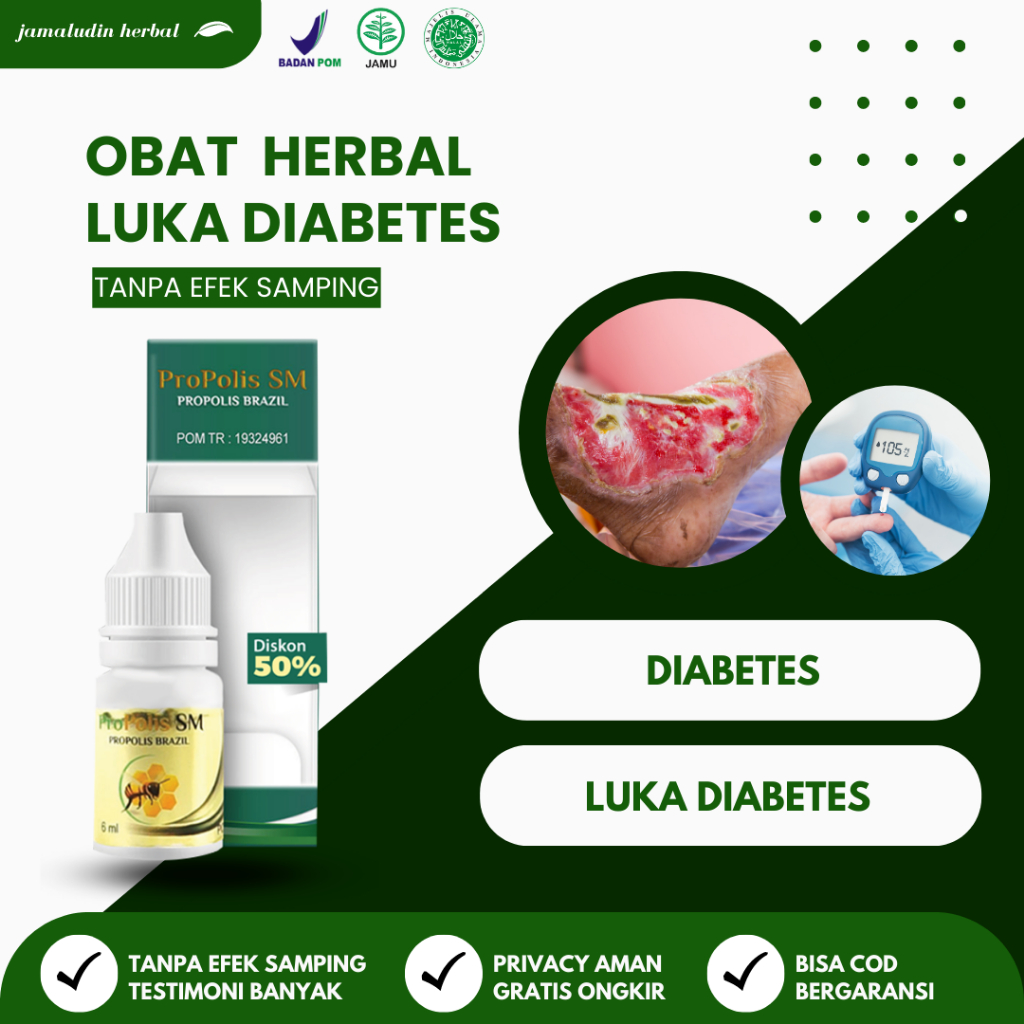 Jual Obat Oles Luka Diabetes Basah Salep Luka Diabetes Gangren