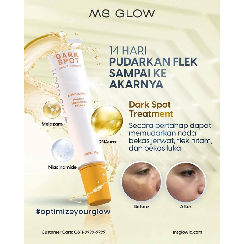 Jual DARK SPOT MS GLOW ED 2025 FLEK TOTOL Shopee Indonesia