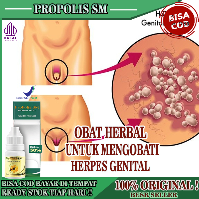 Jual Obat Untuk Herpes Kulit Genital Obat Penyakit Herpes Kulit