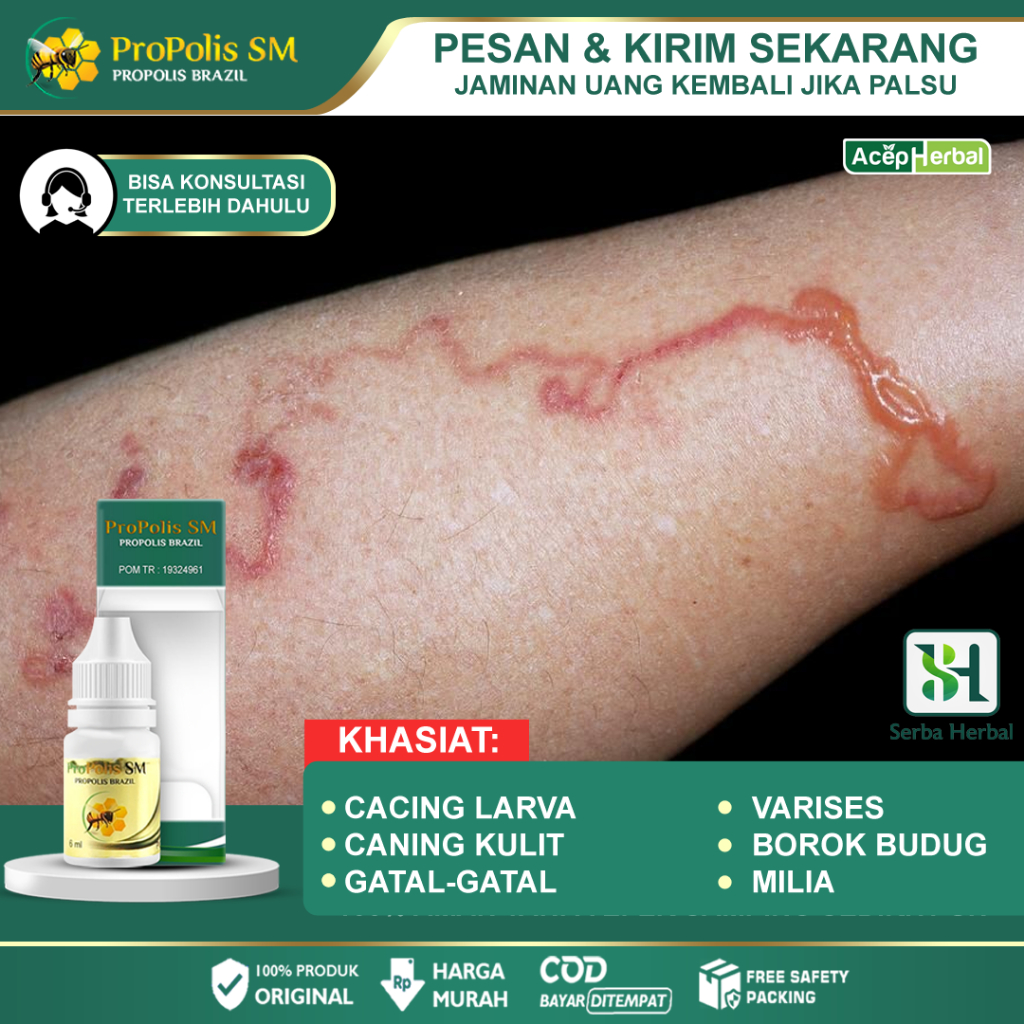 Jual Obat Khusus Cacing Larva Cacing Merayap Di Kulit Pasir Cacing