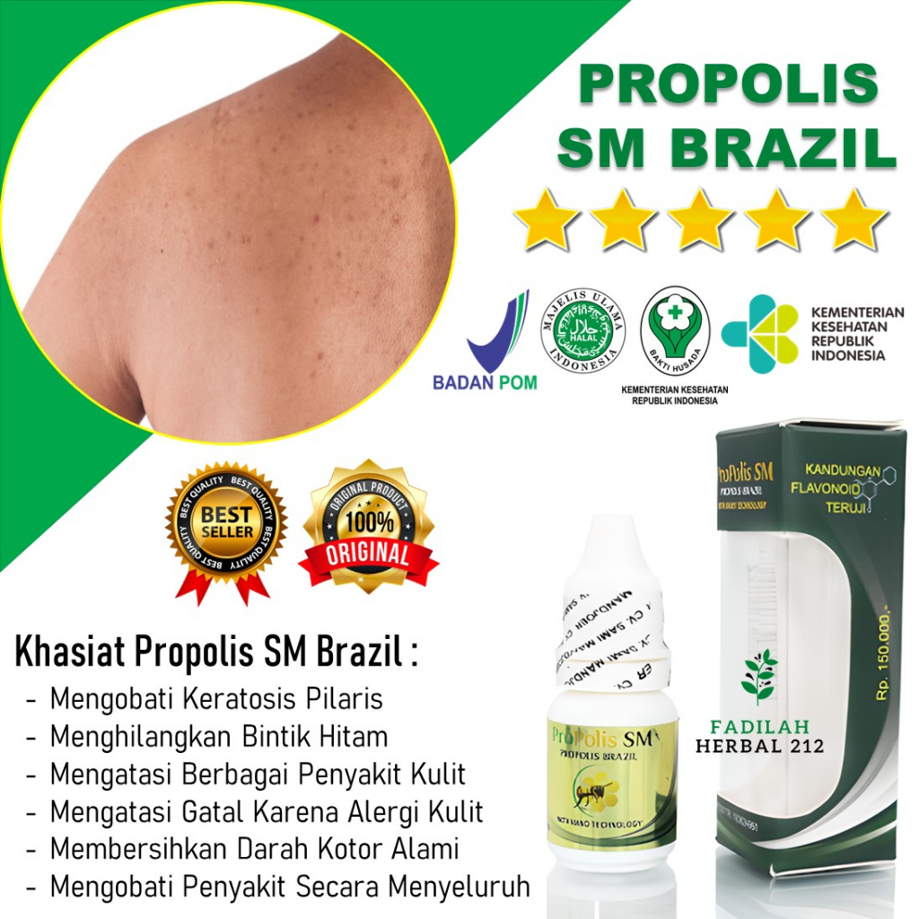 Jual Obat Keratosis Pilaris Bintik Di Kulit Wajah Tangan Dan Badan