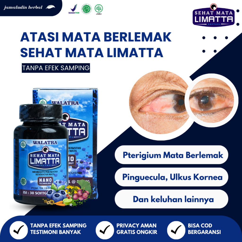 Jual Obat Herbal Mata Berlemak Mata Merah Mata Timbilen SEHAT MATA