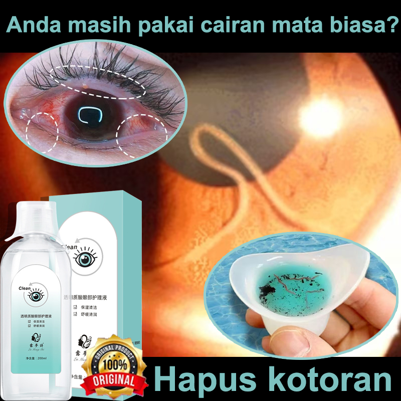 Jual Cod Asliobat Mata Katarak Vitamin Mata Tetes Mata Ml Vitamin