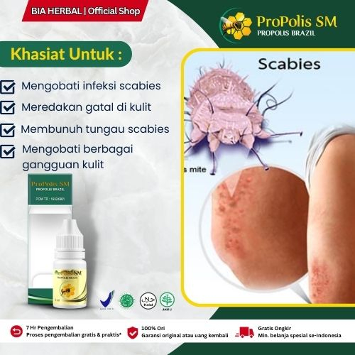 Jual Obat Scabies Rasa Gatal Kemerahan Akibat Infeksi Tungau Pada