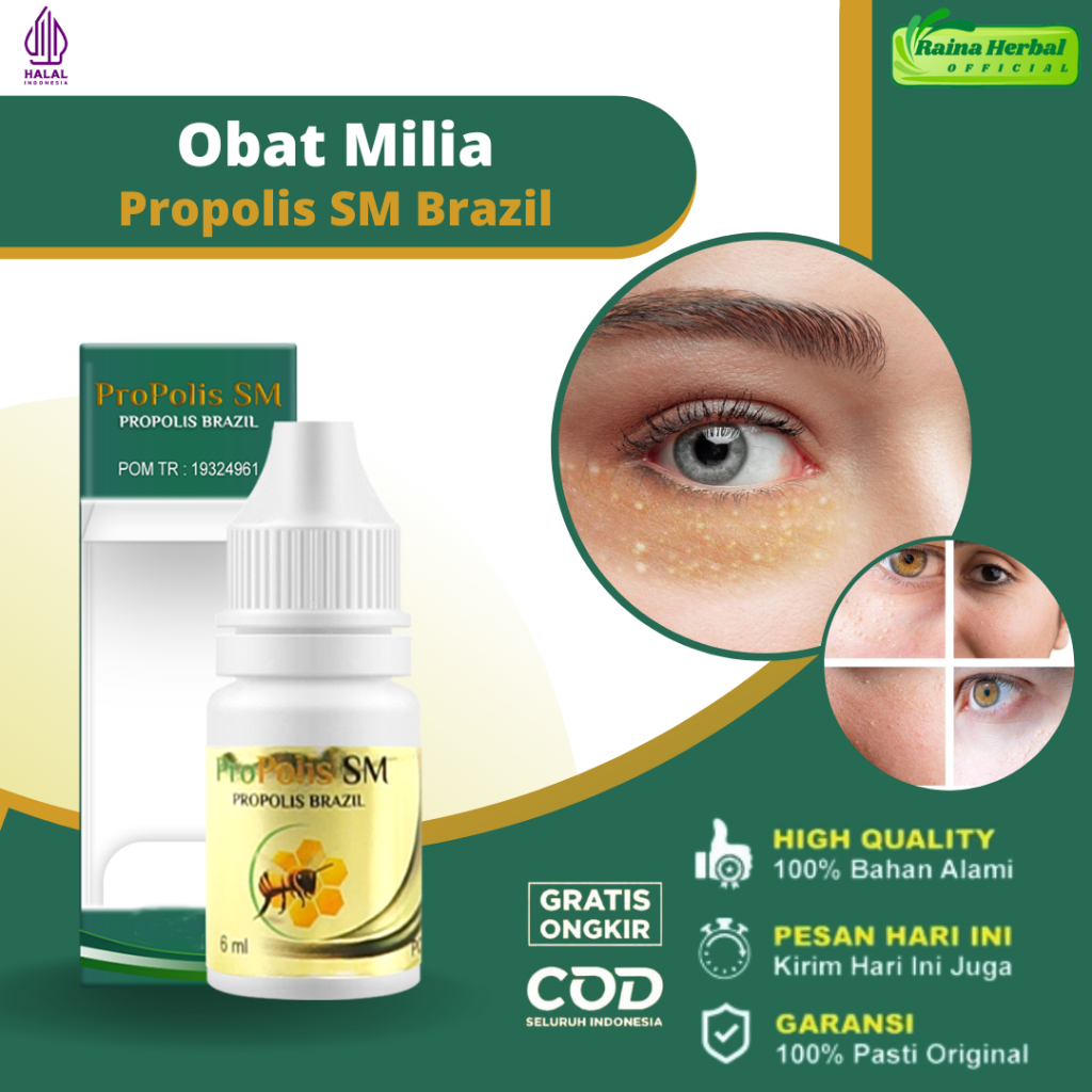 Jual Raina Herbal Obat Oles Penghilang Milia Di Wajah Milia Di Bawah