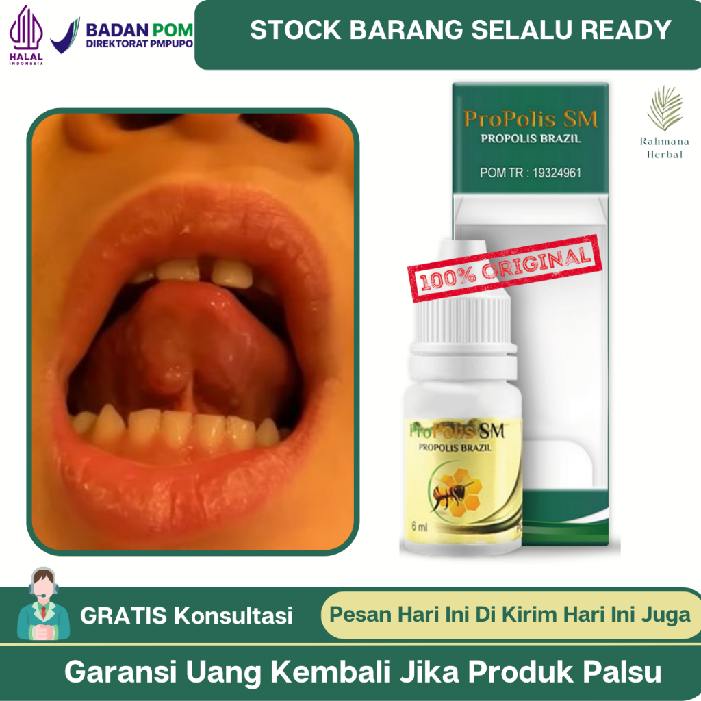 Jual Obat Benjolan Di Bawah Lidah Obat Benjolan Lidah Obat Nyeri