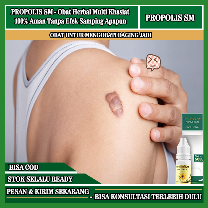 Jual Propolis Sm Obat Pengempis Daging Jadi Obat Penghilang Daging