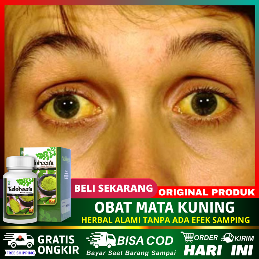 Jual Obat Mata Kuning Hepatitis Penyakit Liver Pemutih Mata Kuning