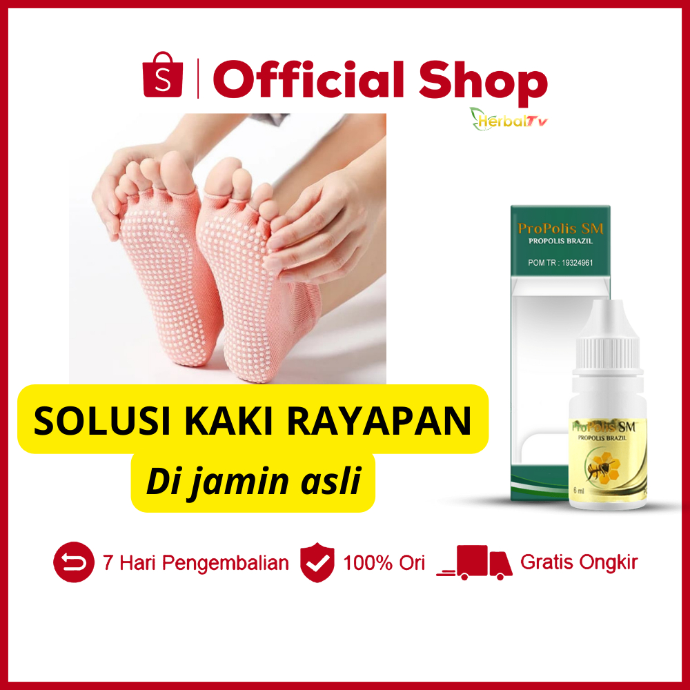 Jual Obat Kaki Rayapan Bau Pitted Keratolysis Infeksi Bakteri Kutu Air