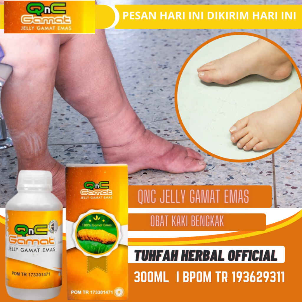 Jual Obat Kaki Bengkak Kaki Bengkak Dan Nyeri Kaki Bengkak Ibu Hamil