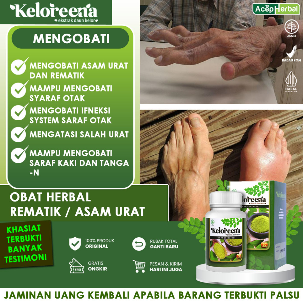 Jual Keloreena Obat Rematik Obat Asam Urat Syaraf Kejepit Kaki