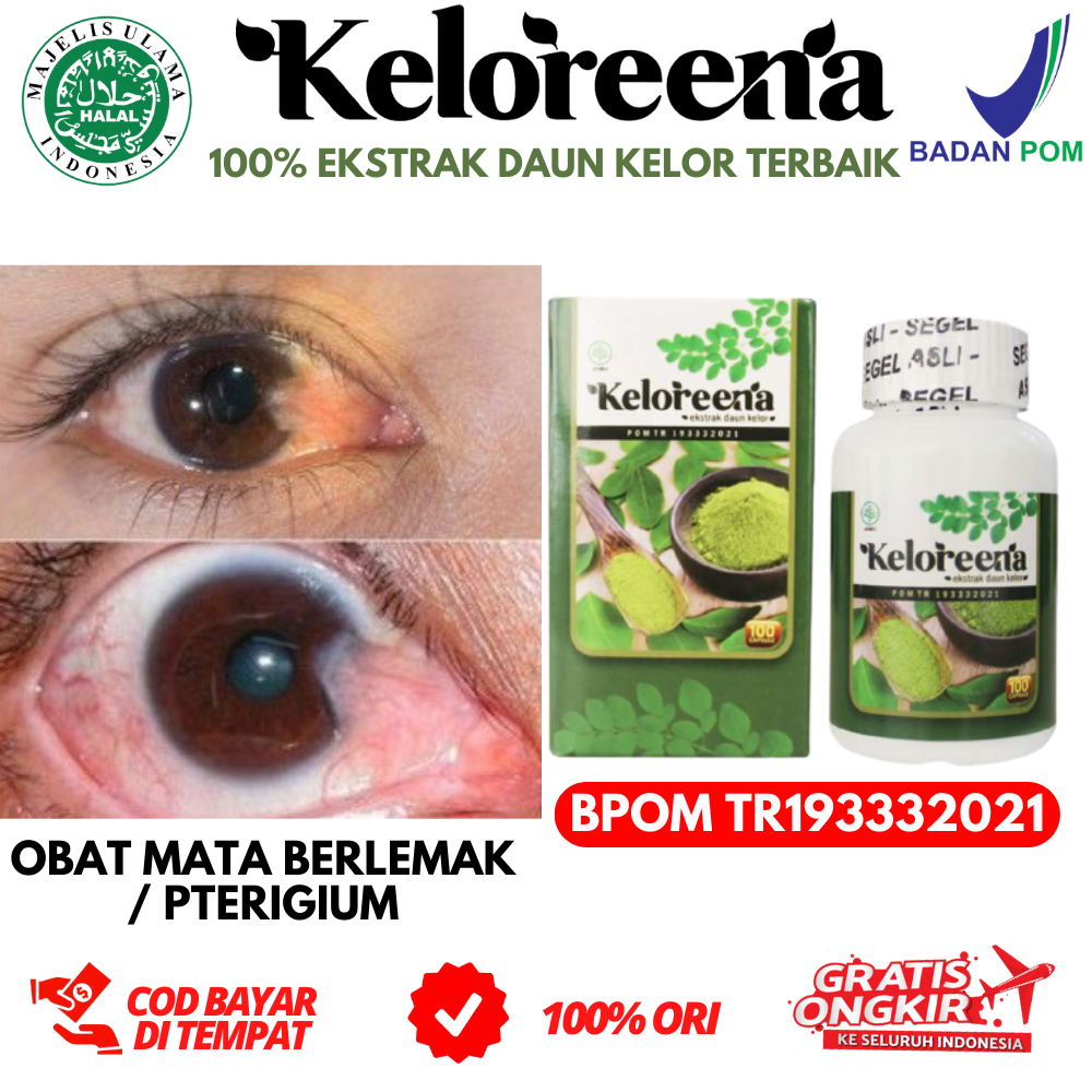 Jual Obat Herbal Mata Berlemak Pterygium Pterigium Pinguecula