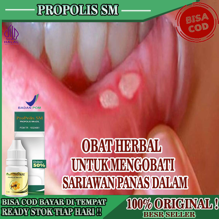 Jual Obat Sariawan Panas Dalam Bibir Pecah Pecah Kering Propolis SM