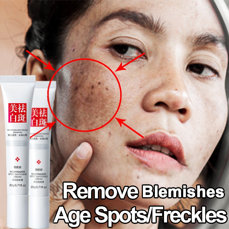 Jual Krim Penghilang Flek Hitam Cream Remove Dark Spots Anti Freckle